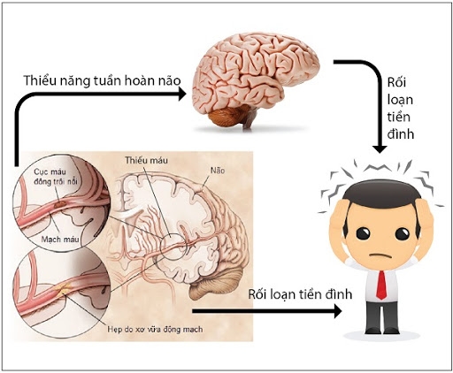 roi-loan-tien-dinh-2